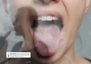 Cara Mengatasi Vape Tongue