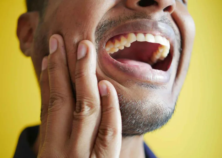 apakah vape bikin gigi kuning