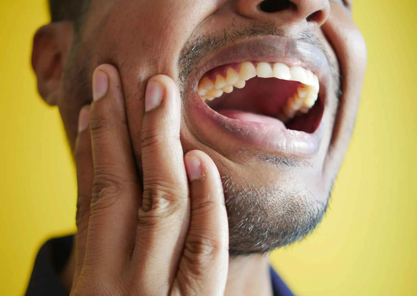 apakah vape bikin gigi kuning